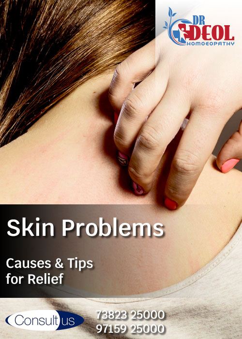 Skin